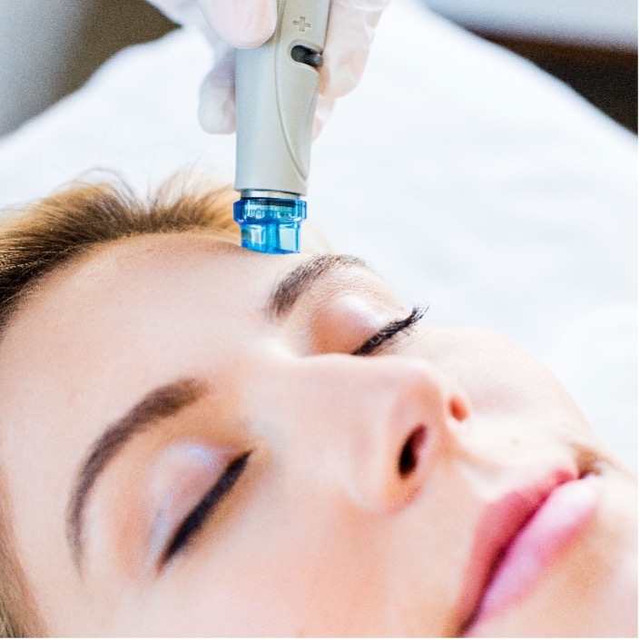 HydraFacial treatment at Face-O-Max